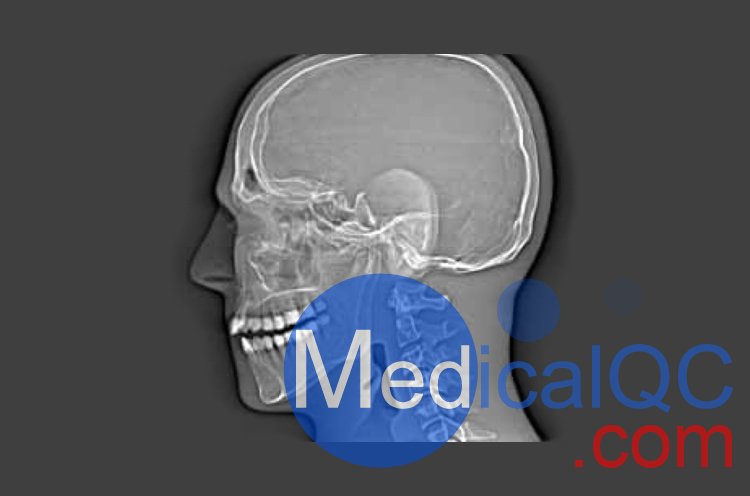 CIRS 711-HN头部模体，CIRS 711-HN CBCT模体