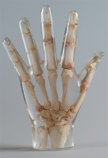 Erler Zimmer天然骨骼模体，Erler Zimmer手掌模体