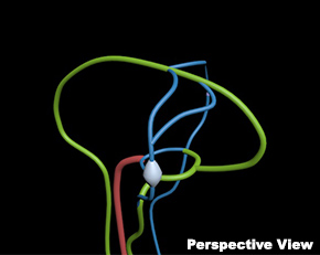 WEK-BV脑血管模体,Brain Vessels模体定制,脑肿瘤血管模体
