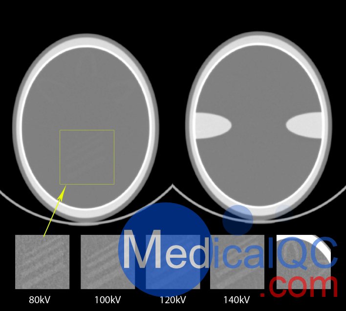 QRM-Cranial-CT-Phantom，颅脑CT模型，Cranial CT Phantom