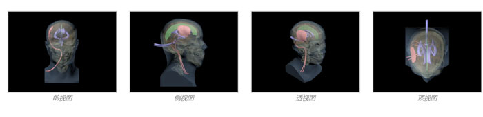 HD-A05血肿头模，HD-A05血肿头部模体设计示图