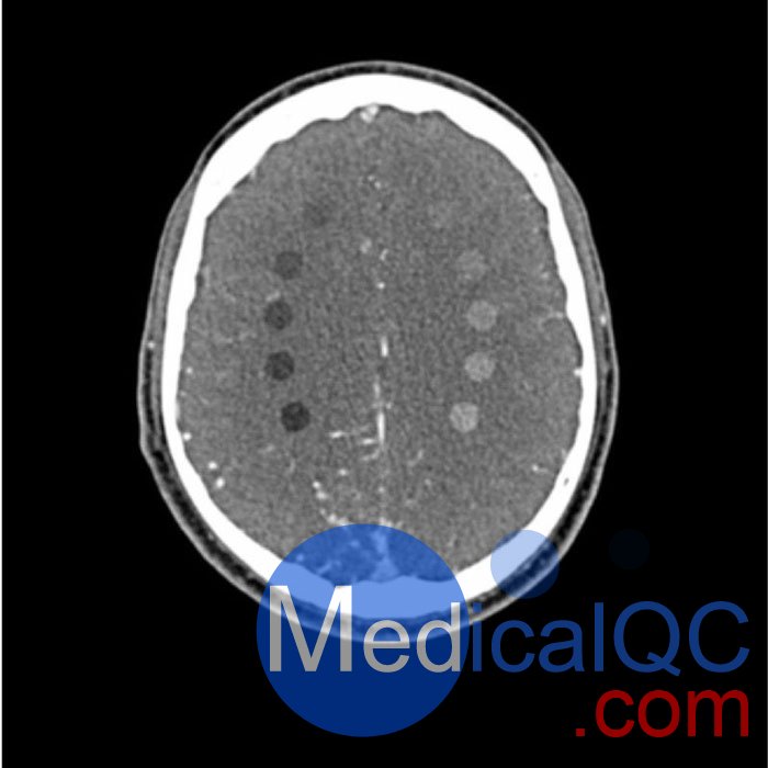 WEK-5005脑血管造影头模，WEK-5005头模， CTA AVM头模成像效果图