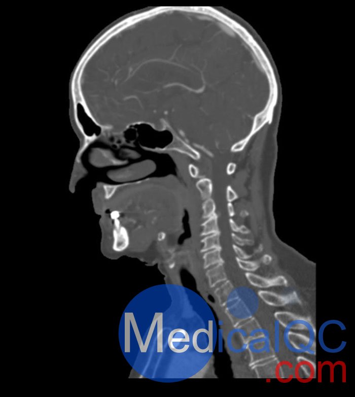 WEK51-02 CT血管造影头模,WEK51-02 CTA头部模型成像效果图