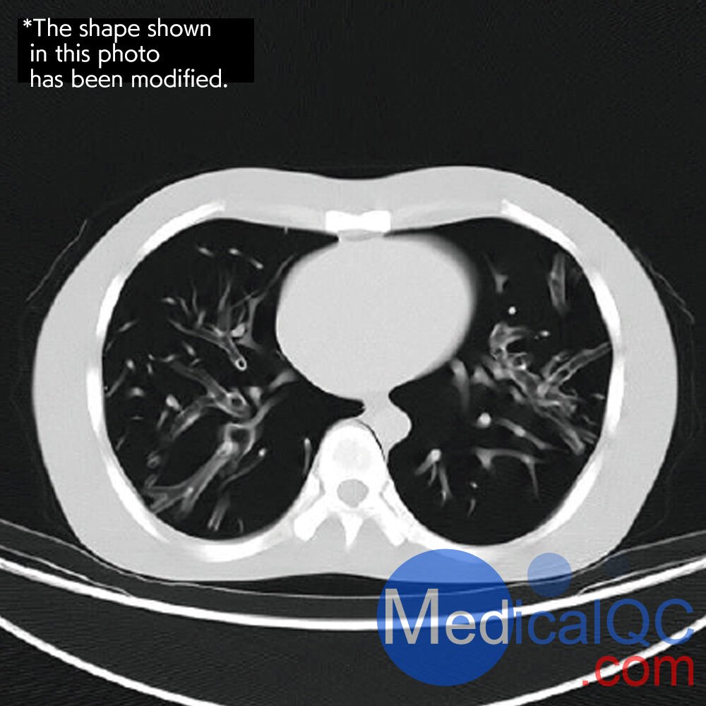 CTU-41 CT躯干模体,PH-4 CT躯干模型,CT人体躯干模型PH-4成像效果